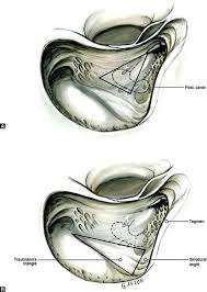 The triangular patch of dura facing the cerebellopontine angle. Jaypeedigital Ebook Reader