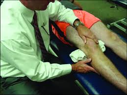 Image result for Patella Mobility Test