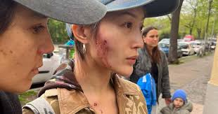 Kim Ann Foxman and Cora assaulted in suspected hate crime