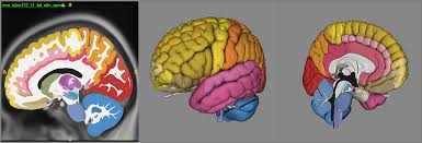 This section of the website will explain large and minute details of axial brain cross sectional anatomy. Allen Brain Map Community Forum