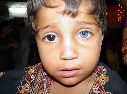 Animals also have the potential to acquire Rare Eyes Rare Eye Colors Different Colored Eyes