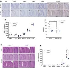 Please if you can donate. Effect Of Nox2 Expression On Microglial Proliferation Ros Production Download Scientific Diagram