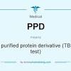 The ppd skin test is a method used to diagnose silent (latent) tuberculosis (tb) infection. 1