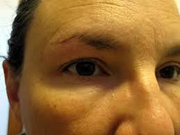 Overall, sugaring is a gentler experience than traditional waxing. Remove Hair With Diy Homemade Sugar Wax Cheap Plastic Free And Dangerous In The Wrong Hands My Plastic Free Life