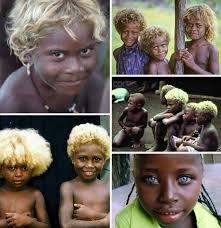 Black Babies Born White Then Turn Black They Were Born This Beautiful Black And Blonde Dear White People African Beauty