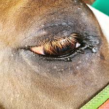 Image result for lesion sclera