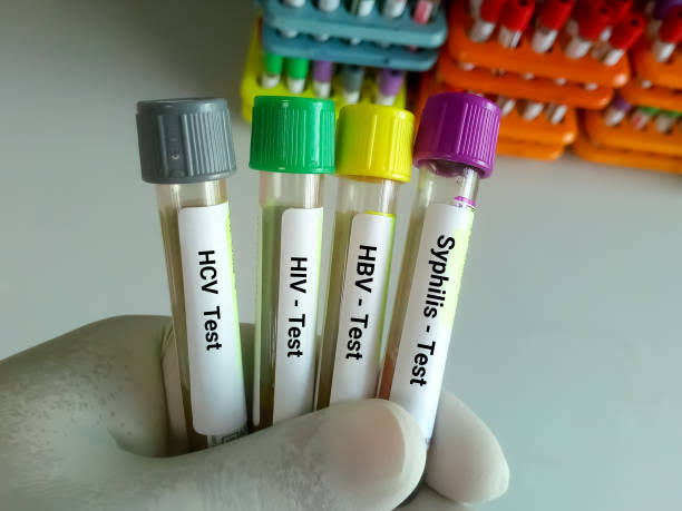 HBSAG ELISA product image