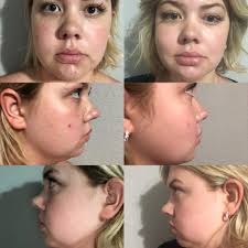 Before and after just a month!