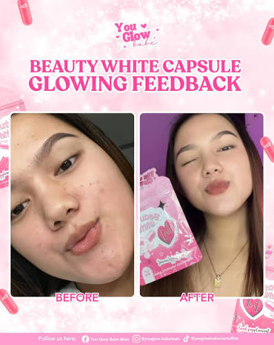 Ito 'yung sikreto ng effortless glow. 👀 With Beauty White Capsule, your  glow starts deeper. Mas radiant, mas confident! Everyday feels like a good  skin day. 💖 #YouGlowBabe #youglowbabemain #ygb #AlagangYouGlowBabe  #BeautyWhiteCapsule