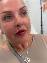 ✨ What you get with me when you choose lip filler… 💋 Beautiful, soft,  natural-looking lips 💉 A treatment tailored to YOU