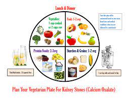 Calcium Oxalate Stone - Causes, Prevention, Treatment | National Kidney  Foundation