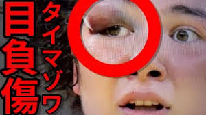 About press copyright contact us creators advertise developers terms privacy policy & safety how youtube works test new features press copyright contact us creators. Mmkpekfenm6hcm