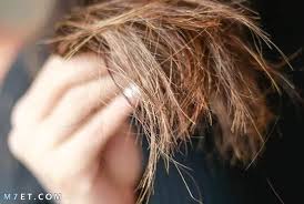 ما هو تقصف الشعر 7 أنواع و7 أسباب منتشرة وطرق العلاج والوقاية المجربة