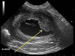 Tcc can be thought of like a very intense version of all that we've explained thus far. Transitional Cell Carcinoma Mar Vista Animal Medical Center