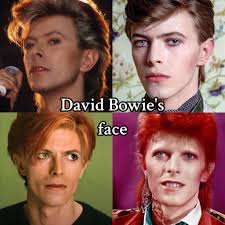What Happened to David Bowie Eyes