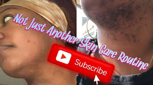 Women who are diagnosed with pcos may experience darker, thicker, or excessive body hair because of excessive body hormones. Not Just Another Skin Care Routine Pcos Laser Hair Removal Youtube Best Skin Care Routine Skin Care Routine Skin Care