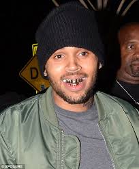Rapper lil' wayne has always had quite a mouth on him. Chris Brown Wears Gold Grills Over His Teeth Daily Mail Online