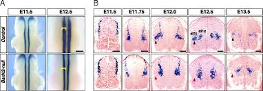 Mar 17, 2018 · ipsilateral (adjective) belonging to or occurring on the same side of the body. Barhl2 Transcription Factor Regulates The Ipsilateral Contralateral Subtype Divergence In Postmitotic Di1 Neurons Of The Developing Spinal Cord Pnas