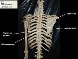 The rib cage is an arrangement of bones in the thorax of all vertebrates except the lamprey. Vertebral Column Ribs And Sternum Fhs122 Anatomy E Lab