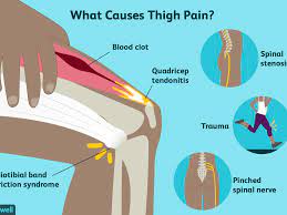This is caused by compression of a nerve known as the lateral cutaneous nerve of the thigh as it passes underneath a tough fibrous ligament known as the inguinal ligament. Thigh Pain Causes Treatment And When To See A Doctor