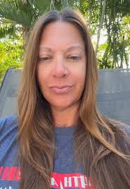 Managing No-See-Um Bites: Tips for Relief and Prevention