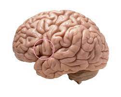 Em alguns casos o afásico de broca. Que Es La Afasia De Broca Tratamiento