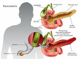 Image result for pancreas)