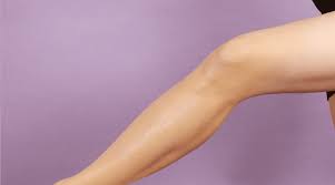 She says multiple laser treatments are usually required (one to four, depending on the severity). What Is The Best Leg Makeup Revelist