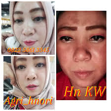 Check spelling or type a new query. Korban Cream Hn Kw Dan Sekarng Agen Cream Hn Original Facebook