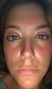 Mark Boerner, MD, Board Certified Ophthalmologist