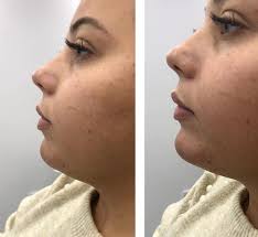 The Wrinkle Room in Dyfed