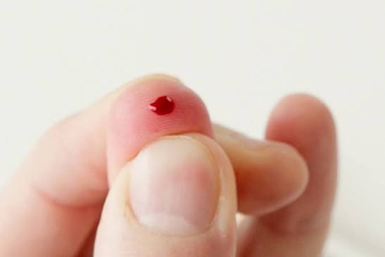 Antibiotiká a vysoké CRP: Kedy naozaj zaberú a ako ich správne užívať? - úvodný obrázok