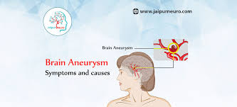 They may never find out they have a brain aneurysm, or it may be found by accident when their brain is scanned for some other reason. Brain Aneurysm Symptoms And Causes Jaipurneuro