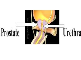 Image result for Expressed Prostatic Secretion