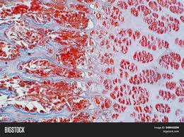 The unit of combact bone, also called a haversian system. Cross Section Human Image Photo Free Trial Bigstock