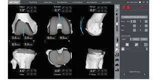 Image result for Patella Tracking Assessment