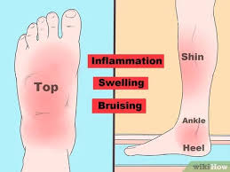 Something that causes another person a lot of stress may leave you perfectly calm. 3 Ways To Identify A Stress Fracture Wikihow