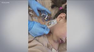 An individual aged <21 years presenting with fever*, laboratory evidence of inflammation**, and evidence of clinically severe illness requiring hospitalization, with multisystem (>2) organ involvement. Dell Children S Has Treated 3 Mis C Cases Since June Cbs8 Com