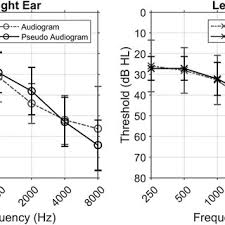 Check spelling or type a new query. Pdf Toward A New Evidence Based Fitting Paradigm For Over The Counter Hearing Aids