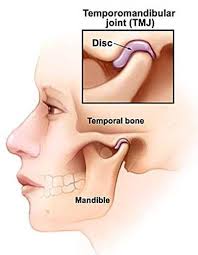 Pin By Ahimara Michel On Med School Temporomandibular Joint Tmj Dental Health