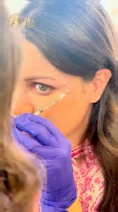 Unlock your youthful glow with our advanced anti-aging treatments!✨ Say  goodbye to wrinkles and hello to radiant, timeless skin. Book your  consultation with Dr. Afnan Hamdan today and discover the secret to