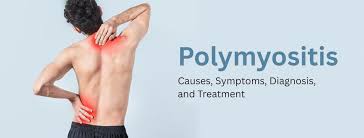 Image result for Polymyositis