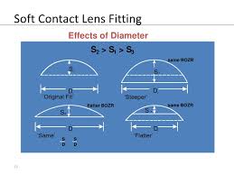 Soft Contact Lens Fitting