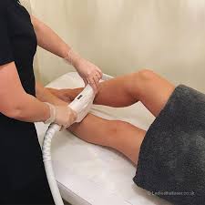 It's called laser hair removal, and the word laser doesn't exactly have a cuddly connotation. Laser Hair Removal Frequently Asked Questions Does It Hurt How Long Does It Take