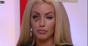 Aveam mulți bani și o brățară! Loredana Chivu Atacata De Un Talhar Cat De Rau Arata Diva Dupa Confruntarea Cu Infractorul