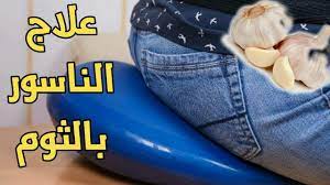 pin on في العيادة filel3yada