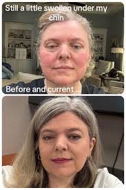 Plastic surgery update