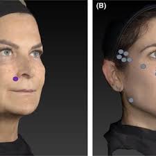 PDF) Esthetic considerations for treating the patient of European descent:  Thriving in diversity international roundtable series