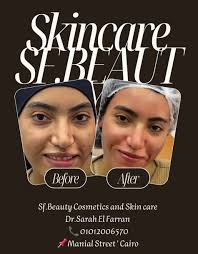 العرايس 🫰 اي حد عايز يهتم بنفسه الاسكراب و الدلكه عندنا غيييير شايفين  المنظر ده 😉 كل الجلد الميت هنتخلص منه و نعالج جلد الوزه كمان ✌️😉