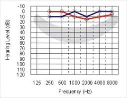 Image result for Audiogram